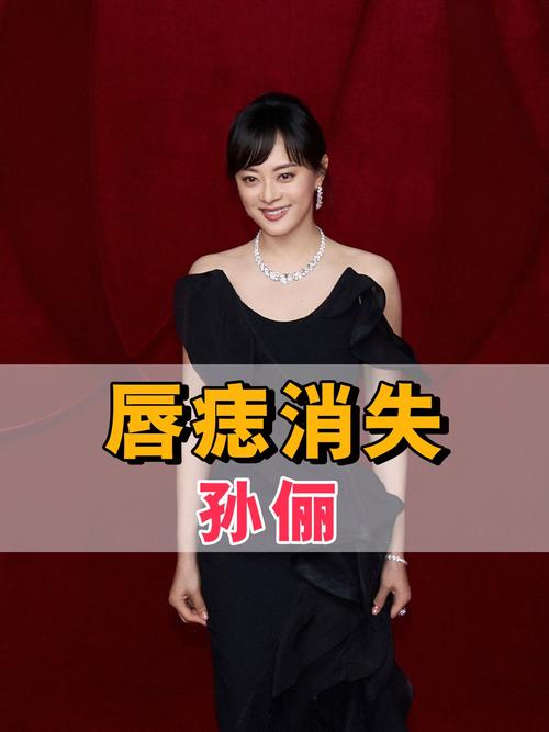 2025澳门开奖结果查询和孙俪唇下痣没了与孙俪嘴唇的痣